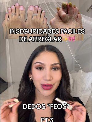 #inseguridades #inseguridadesfacilesdearreglar #uglytoes #dedosfeos #pedicureforuglyfeet #cuidadopersonal #SelfCare #cuidadopersonal #cuidadofeminino #autoestima #amorpropio #selflove #selfcaretiktok #selfcareroutine #autocuidado #amadecasa #consejosparamujeres #girlythings #howtolookfeminine #elegantnails #unaselegantes #elegantpedicure 