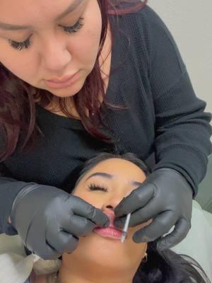 Finally  getting my old lip fillers dissolved thank you @Qtee Beauty 💋  🙏🏼💕 #laredotx #laredotexas #laredoinfluencer #lipfiller  #lipfillerdissolve