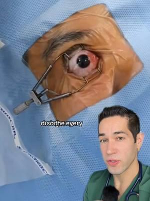 Not as painful as it looks! #eyesurgery #surgery #medical #doctor