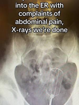 Happy Holiday’s tho lol 🎅🎄🤣🙄🤦🏻‍♀️ #merrychristmas #ER #xrays #foryoupage #xraytech #ERnurse #nurses #fypシ゚viral #humor #hospitaltiktoks #xray 