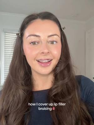 How I cover up lip filler bruising #lipfiller #lipfillerquestions 