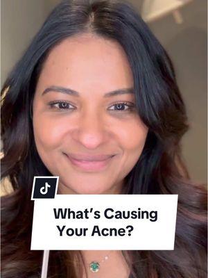 Want to know what’s cause your breakouts? Here are some potential reasons!  #acnefacemap #acne #acnecauses 