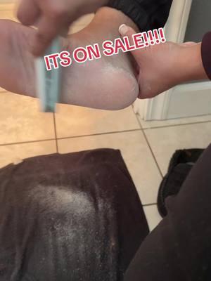 ITS ON SALE!!!!!#feet#pedicure#foothealth#sale#getitnow#fyp 