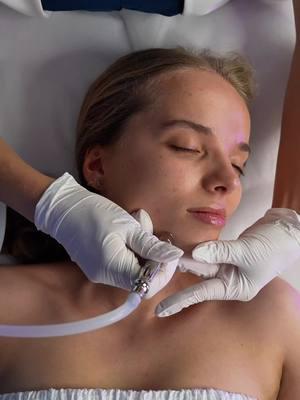 Vacuum Facial Massage: Trend or Transformation? 🤔 Vacuum facial massage has taken the beauty world by storm, but is it just another trend, or does it actually deliver results? Let’s debunk the myths and explore the science behind this technology! ✨ Myth: Vacuum massage overstretches the skin. ✅ Truth: When performed correctly, vacuum massage stimulates collagen production and boosts blood circulation without damaging the skin. ✨ Myth: It’s only for mature skin. ✅ Truth: This therapy benefits all skin types by promoting lymphatic drainage, reducing puffiness, and enhancing the skin’s natural glow. ✨ Benefits You’ll Love: 1️⃣ Lifts and sculpts: The suction effect stimulates the muscles and improves elasticity, giving your face a natural lift. 2️⃣ Detoxifies: Encourages lymphatic drainage, eliminating toxins for a healthier complexion. 3️⃣ Boosts product absorption: Prepares the skin to better absorb serums and creams for maximum results. 💡 Want to know more about this technology or the Jolli Peel device? If you’re interested in learning more or purchasing this professional-grade device, leave a + in the comments, and our team will provide all the details you need! #VacuumFacialMassage #SkinLifting #FacialGlow #JolliPeel #SkincareTrends #SkinDetox #SkinSculpting #AestheticResults