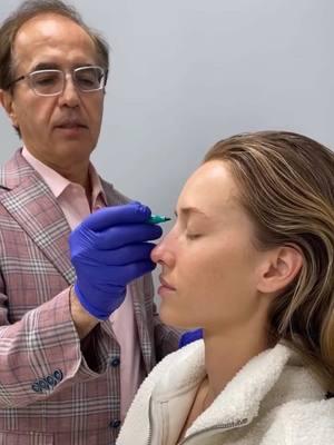 Our beautiful patient here has a few subtle dips and bumps along her nose, with a slight tip droop. Today, we’re going to focus on bringing balance and softness without overcorrecting—because the goal is always natural results. We’ll support the tip and add a bit of filler along the bridge to smooth out those gentle curves, maintaining her unique contours. Sometimes, we’ll even use a touch of Botox to relax the muscle that causes the tip to dip, giving a subtle lift. 🎥 Stay tuned for Part 2 to see the process! #NaturalResults #NonSurgicalNoseJob #BeautyInBalance #LiquidRhinoplasty #NonSurgicalNoseJob #NoseFiller #NonSurgicalRhinoplasty #NoseContour #RhinoplastyWithoutSurgery #NoseFillerTransformation #NoseFillerBeforeAfter #NonInvasiveNoseJob #LiquidNoseJob #NonSurgicalEnhancement #NoseJobAlternative #RhinoplastyResults #NaturalNoseContour #NoseTransformation