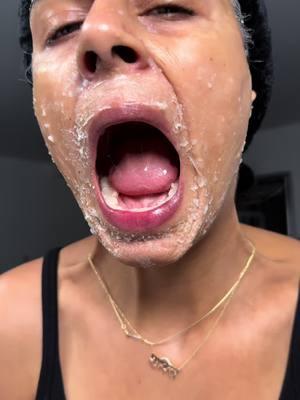 This 2 ingredient DIY mask works for almost everyone!!  Take 3tbsp rice  Wash it  Boil it and blend it Once it’s cool, add honey Apply and wait until it’s dry Rinse and moisturize!!  #ricemask #DIY #skincare #skin 