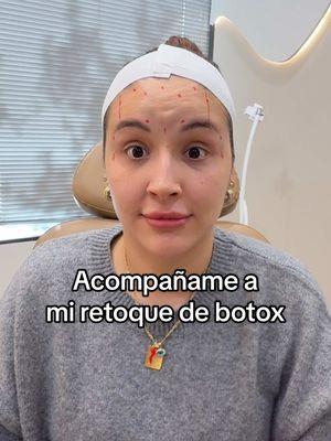 El botox me cambio la mirada, amo el efevto de como me levanta las cejas🥹💛✨ @Esthetic skin spa si estan en Houston, Tx tienen que ir con Yubi, es la mejor y siempre apostando a lo natural🥹✨ #botox #botoxcheck #retoquedebotox #liftingdecejas #facelifting #botoxfacial 