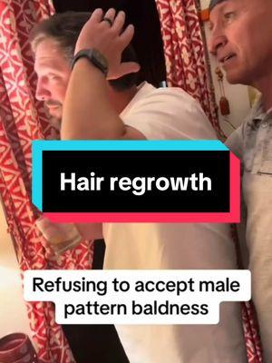 😐 Please start #balding #menshealth #malepatternbaldness #bald #hairthinning #gettingold