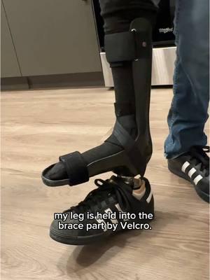 #Prosthesis #Prosthetic #Leg #Foot #Health #Appointment #Medical #Hospital #ServiceDog #Disabled #Disability #FYP #ForYou  #TikTok #ForYouPage #Dog #Working #Job #WorkingDog #BlackLab 