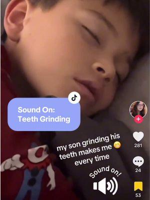 This is a great example of what teeth grinding sounds like! While the noise can be very unsettling, it’s actually quite common in children. If you’re still having concerns though, consider scheduling an appointment with your Pediatric Dentist for a check-up. Do any other parents out there have children who grind their teeth? 👀 Share your experiences in the comments below! — #TeethGrinding #fypシ #ArizonaDentist #DentistReaction #BoardCertified #KidsDentalTips