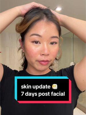 7 days post facial and my skin is still peeling 😅 #acne #chemicalpeel #acnefacial #facial #skincare @APRILSKIN US @EADEM @CeraVe 