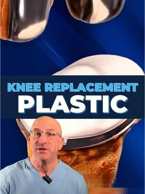 Modern (Plastic) Knee Replacement Parts 🦿 The success of your #kneereplacement surgery largely depends on a special plastic called Ultra-High Molecular Weight Polyethylene (UHMWPE). This remarkable material has been the gold standard in joint replacements since the 1960s, and continued innovations are making it even better. Today's advanced crosslinked polyethylene implants (HXLPE) are engineered to be incredibly wear-resistant while maintaining the strength needed to support your daily activities, like your joint's new shock absorber, designed to last for decades. #jointreplacement  . Studies show these modern polyethylene materials can reduce wear by up to 90% vs materials used in earlier implants. Highly-crosslinked high-molecular weight polyethylene used in modern implants is so durable that it would take about 20-30 yrs of normal use to wear down just 1mm and that's why most modern joint replacements last for life. The future looks even brighter with ongoing research and #medicalinnovation - Talk to your orthopedic surgeon about the latest advancements in hip and knee #jointreplacement technology. . 👇 SHARE your new hip or knee experience. What joint replacement questions do you have?