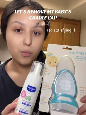 do you remove your baby’s cradle cap?? 🫶🏼🥰🫧 #newborn #cradlecap #postpartum #onemonthold #momtok #youngmomsoftiktok #youngmom 