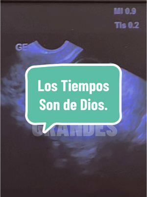 Positive Thinking #2 Los tiempos son de Dios.  #Adversidad #MentePositiva #ActitudPositiva #SuperaciónPersonal #Éxito #ConfianzaEnDios #FeEnDios #LograrSueños #SalirAdelante #CrecimientoPersonal #ConfíaEnDios #FeQueMueveMontañas #DiosEsFiel #DiosGuíaMiCamino #CaminaConFe #DiosTieneElControl #MiFeEsMiFuerza #DiosNuncaFalla #FeInquebrantable #FéEnSuPalabra #DiosEsMiRefugio #DiosEsAmor #VivirEnFe #LaFeTodoLoPuede #DiosSiempreEstá #FéQueInspira #DiosEsMiGuía #PoderDeLaFe #FéActiva #DiosEsMiFortaleza #DiosPrimero #FéInquebrantable #CaminoDeFe #ViviendoEnFe #DiosEsMiEsperanza #LaFeEsClave #ConfiandoEnSuPlan #FéEnElProceso #DiosNuncaAbandona #FéYEsperanza #FeInquebrantable #DiosLoPuedeTodo #FeEnDiosSiempre #DiosEsMiLuz #LaFeMeSostiene #TodoPorLaFe #ConfíoEnSuTiempo #DiosEsMiTodo #FéSinLímites #CreeEnDios #DiosEsGrande #FéQueTransforma #EsperanzaEnDios #DiosMiRoca #FéConstante #DiosEsPaz #FortalezaEnDios #FéEnAcción #AmorYFe #DiosEstáConmigo #Determinación #Persistencia #Resiliencia #VivirConPropósito #TodoEsPosible #NuncaTeRindas #Motivación #Inspiración #PasosFirmes #CreerEnUnoMismo #ActitudDeÉxito #MentalidadGanadora #Adversity #PositiveMindset #FaithInGod #TrustTheProcess #OvercomingObstacles #SuccessJourney #BelieveInYourself #NeverGiveUp #KeepMovingForward #StayFocused #DreamBig #FaithOverFear #WinningMindset #OvercomeChallenges #GrowthMindset #StrengthThroughFaith #SuccessIsHard #TrustInPeople #FaithLeadsTheWay #StayMotivated #AchieveGreatness #HardWorkPaysOff #GodIsWithYou #SuccessTakesTime #StayCommitted #PositiveEnergy #EmbraceTheStruggle #ConfidenceInPeople