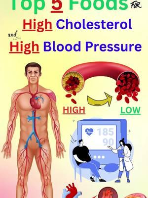 Top 5 Foods for High Cholesterol and High Blood Pressure #Foods #Cholesterol #HighBloodPressure #BloodPressure #almonds #walnuts #hearthealthy #healthyfats #fiber #omega3 #fattyacids #magnesium #bloodpressure #Fattyfish #salmon #mackerel #sardines  #Oats #wholegrains #grains #solublefiber #badcholesterol #breakfast #Fruits #vegetables #berries #apples #oranges #spinach #cabbage #carrots #body  #heart  #vitamins #vitamin  #antioxidants #Darkchocolate #chocolate #cocoa #flavonoids #moderation #calories