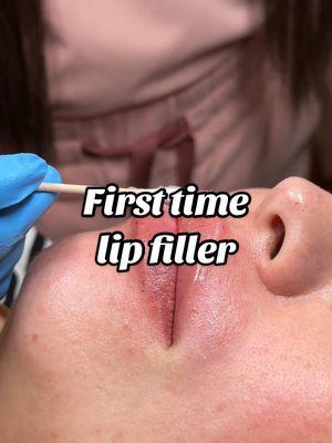 Results at the end! #injections #lipfiller #SelfCare #late30s  #botox #lipplump #firsttimebotoxer #botoxfirsttimer #lipinjectionbeforeandafter #beforeandafter #lipfillerbeforeandafter #medspa #bellabarmedspa #creatorsearchinsights 