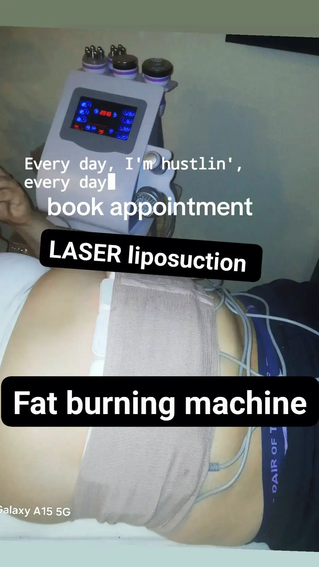 #fyp #laserlipo #cavitationtreatment#cavitation#viralvideo #foryoupageofficiall2024tiktokviral #promote #explorepage 