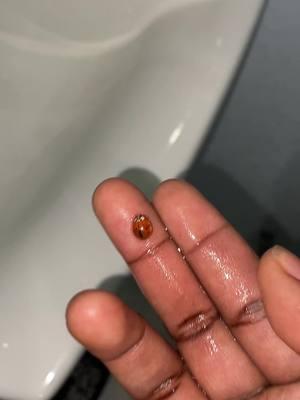 apparently my first aid certification applies to bugs too #ladybug #bug #drowning #sad #water #toilet #swimming #insects #saved #helpinghand #funnyvideo #dahood #pov #cpr #CPR #firstaid #ftm #🏳️‍⚧️ #ftmtransgender #lgbt #fyp #viralvideo #aura #savior #animals #animallovers #buglovers #insectlovers #rodent 