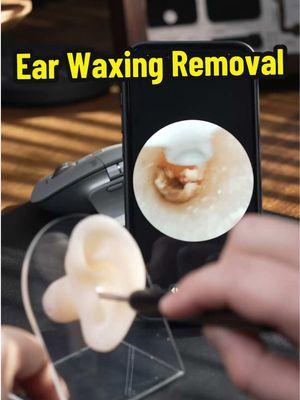 Ear Wax Cleaning Removal Tool Handheld With Camera LED Light Portable Tool for Hygiene Clogged ears Better Hearing#TikTokShopLastChance #tiktokshopnewyearnewaura #spotlightfinds #ear #earwax #earwaxremoval #earwaxcleaning #hygine #clean #earwaxremmoval #earclean #earcleaningtools #goodthingstoshare