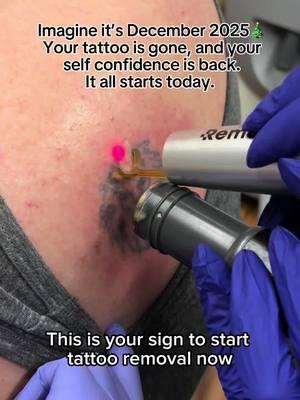 There's no better time to get started✨ Make next year the year you say goodbye to the tattoos that no longer feel like you. With 150 global locations, there's always a Removery near you. Use our link in bio to find your studio today🔗 #removery #tattooremoval #lasertattooremoval #beforeandaftertattoo #fading #tattoofading #fadingtattoos #tattoocoverup #removetattoos #ustattooremoval #australiatattooremoval #canadatattooremoval #facetattoo #facetattooremoval