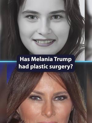 Melania Trump's NEW FACE #MelaniaTrump #Trump #Celebrity #PlasticSurgery #PlasticSurgeon #Surgeon #Surgery #fyp