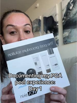 PCA Ultra peel journey for dark spots, melasma, and overall tone and texture. This is day 1 #pcaskin #pcapeel #skinpeel #hyperpigmentation #melasma #vipeel 