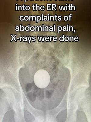 We are tired. Merry Christmas 🎄😂🤦🏻‍♀️🙄🤣🤷🏻‍♀️😭 #xrays #ER #xraytech #hospitallife #fypシ゚viral #hospitaltiktoks #ERnurses #nursesoftiktok #fyp #humor #jokes #xray 