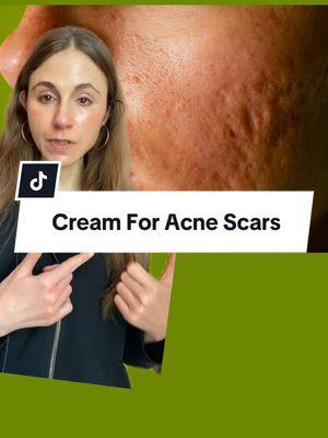 Face cream for acne scars? #acnescars #acnescartreatment #dermatologist 