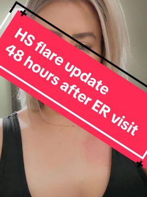 HS flare update- 48 hours after ER visit #creatorsearchinsights #immune #immunedisease #womenhealth #healthy #inflammation #  #hidradenitissuppurativa #livingwith#livingwithHidradenitissuppurativa #livingwithHS #ivantibotics #medicationathome #medicalcareathome #hsskin #hsskindiease #hsscars #tiktok #postontiktok #postdaily #posttomakemoney #makingmoneyontiktok #fyp #watchtohelppaymedicalbills #medical #medicalbills