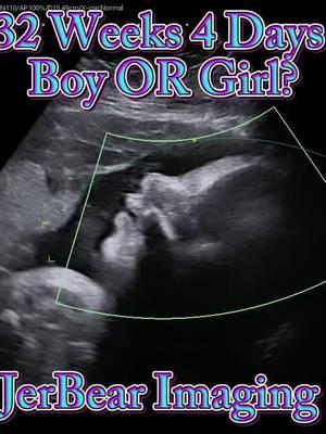 Boy OR Girl?  #jerbearimaging #32weeks4days #girlorboy #boyorgirl #electiveultrasound #fyp  #baby #pinkorblue #blueorpink #genderreveal #genderultrasound #heorshe #heorshewhatwillitbe #brownwoodtx