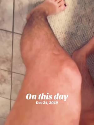 #onthisday OVER 20 MILLION VIEWS! 😱 It’s been some years since my video went viral! 🤣 #hairylegs #hair #nair #embarrassing  