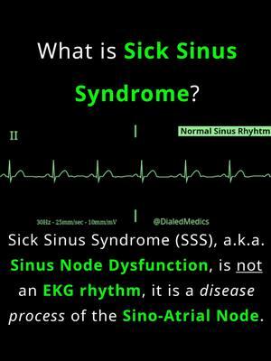 🤧🫀🤔 Sick Sinus Syndrome (a.k.a. Sinus Node Dysfunction) is a disorder of the Sino-Atrial Node which causes patients to have a host of sinus-related dysrhythmia. This can include, but is not limited to: Sinus Bradycardia, Sinus Tachycardia, Sinus Arrhythmia, Sinus Pauses / Arrests, Sinus Exit Blocks, Wandering Atrial Pacemaker or Multifocal Atrial Tachycardia, Atrial Fibrillation, AV Nodal Reentrant Tachycardia, Atrioventricular Reentrant Tachycardia (if accessory pathways are present), Ectopic Atrial Rhythms, and Junctional or Ventricular Escape Rhythms. SSS is often accompanied by Tachy-Brady Syndrome, where patients experience both inappropriate paroxysmal bradycardias and tachycardias. SSS patients can be broadly categorized into those who experience tachyarrhythmias (more common) and those who only have bradyarrhythmias. These dysrhythmias are usually intermittent, and symptoms of instability associated with SSS are as well, coming and going as patients experience periods of these rhythms. Symptoms and instability are rate related, with pts experiencing low cardiac output from tachycardic or bradycardic rates. Symptoms may present as syncope or near syncope, palpitations, a feeling of a racing heart rate, weakness, fatigue, or patients may be asymptomatic. Causes of SSS are broad ranging and largely fall into intrinsic or extrinsic categories. Intrinsic causes are those primarily related to the heart itself, such as channelopathies, cardiomyopathies, ischemia, fibrosis, myocarditis, etc. While extrinsic causes are systemic, such as electrolyte imbalances, drug toxicity (especially digoxin), hyper and hypo thyroidism, etc. Emergent treatment for symptomatic unstable dysrhythmias associated with SSS should follow standard ACLS bradycardia or tachycardia algorithms, and definitive treatment outside of extrinsic reversible causes often requires permanent pacemaker placement. All EKG recordings are from the EKG rhythm generator on my website (LII rhythms only for now, 12Ls are in beta and coming soon), be sure to check it out for more software generated #ECG practice! (Link in bio.) #EMS #ACLS #emstok #paramedic #paramedicsoftiktok #medic #medicsoftiktok #flightmedic #criticalcareparamedic #paramedicstudent #paramedicschool #emta #emtb #emt #emtlife #emtsoftiktok #emtstudent #emtschool #firstresponders #NREMT #nurse #nursesoftiktok #RN #nursingstudent #nursingschool #flightnurse #criticalcarenurse #emergencynurse #NCLEX #nclexrn #nclexprep #doctor #doctorsoftiktok #medicalstudent #USMLE #emergencymedicine #criticalcare #cardiology #FOAMED 