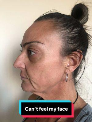 Facial rejuvenation is more than just a face and neck lift! for your free consult with Dr. Espino Please email us today! ##fyp##mexicosurgery##medicaltourism##plasticsurgery##eoc##facelift##necklift##blepharoplasty##eyelift##deepplanefacelift##transformation##drespino##lipflip##liplift##browlift