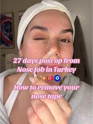 27 days post op from my rhinoplasty surgery in Turkey! Let me show you how I remove my nose tape 👃🏼✨🇹🇷🧿🫶🏼 And if you haven’t already, hit the follow button if you’d like to see more nose job related content, as well as other content related to beauty, wellness, and lifestyle! 🫶🏼✨💕 @GarnierUSA #garnierskinactive #garniermicellarwater #micellarwater #nosejob #rhinoplasty #nosejobrecovery #nosejobhealing #nosejobdiary #turkeynosejob #rhinoplastyhealing #turkeyrhinoplasty #rhinoplastyquestions #surgeryinturkey #newnose #newnosewhodis #nosejobcheck #nosejobaftercare #nosejobpostop #nosejobinturkey  