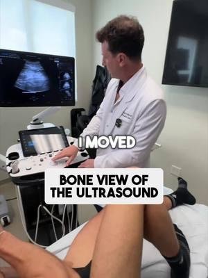 Our ultrasound equipment is so advanced, we can even see the bone in remarkable detail. This level of precision is a game-changer for diagnosing injuries, guiding treatments, and monitoring recovery with pinpoint accuracy. Seeing deeper means treating smarter! #ultrasoundtechnology #medicalinnovation #precisioncare #injurydiagnosis #advancedimaging #healthcaretools #osteocare 