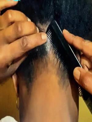 #dandruff #dandruffscratching #dandruffremoval #dandruffremovel #asmrvideo #fypage #satisfyingvideos #psoriasis #capcutedit #capcut