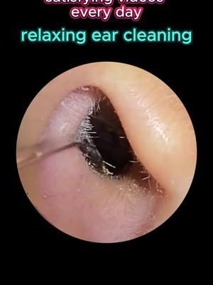 Relax with me 😜 #earwax #ear #earwaxremoval #satisfying #asmr #relax 