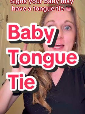 Does your child have a tongue tie? You’re not alone! While it may be scary at first, your dentist and doctor can help. #tonguetie #tonguetied #babytongue #babytonguetie 