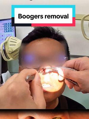 Boogers removal for a man with stuffy nose #boogers #boogerremoval #cleaning #nose #nasal #sinusrelief 