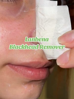 @Lanbena #porestripremoval #lanbena #blackheadremover 