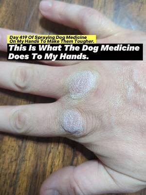 Day 419 Of Spraying Dog Medicine On My Hands To Make Them Tougher. This Is What The Dog Medicine Does To My Hands. #roughhands #dogmedicine #ironfist #martialarts #sandpaper #boxing #ballisticdummy #badmintontraining #toughhandspray #dogspray #softhands #bluecollar #asmr #oddlysatisfying #microfibertowel #skincareroutine #fistofthedogmedicine #fyp 