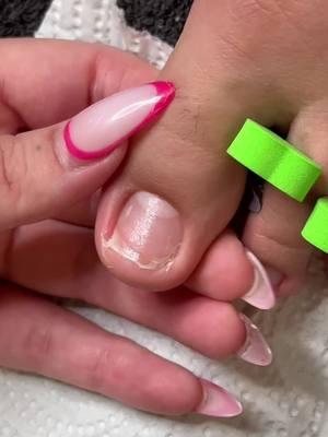 Acrylic application on the big toe ❤️ #nails #toenails #toebbl #nailtech #toenailreconstruction #phoenixnails 