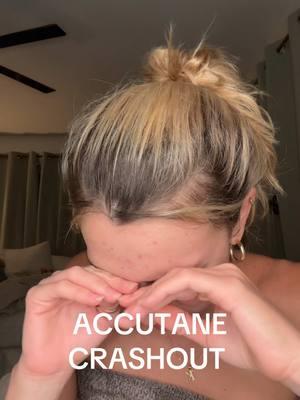 accutane crashout core #accutane #accutanejourney #skincare #acne #acnejourney #acnejourneytoclearskin #accutanecheck #acneskin #acneproneskin #acneskincare #accutanecheck #accutanepurge #help 