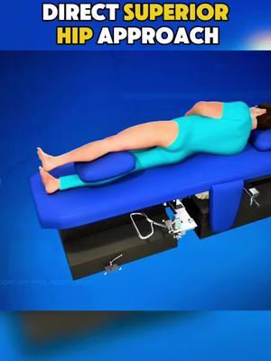 Direct Superior Hip Approach Medical Animation 3D #directsuperiorhipapproach #coldapproach #hip #hipsurgery #hipreplacment #hipreplacementrecovery #hipreplacementsuccess #medicalanimation 