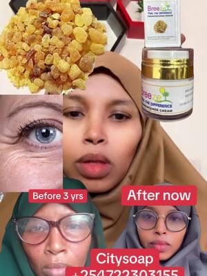 Frankinsence Serum & cream #somalitiktok #somalia #muqdishotiktok #muqdisho #hargaysa #kenyantiktok #nairobitiktokers #nairobi #isliinairobi #islii #mombasatiktokers #garissatiktoker #viraltiktok #syria #viralvideo #mytype #salon #skincare 