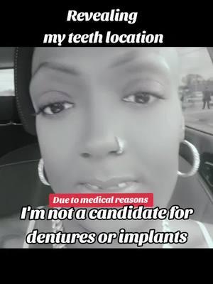 #missingteeth #medicalreasons #auntiegellunclerich #dentures #dental #implants #fyp #foryoupage 