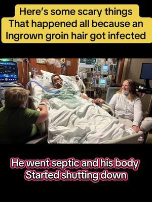 #lifesupport #coma #intubated #wakingupfromacoma #drsmakemistakes #medical #brotherskeeper #foryoupage #ingrownhair #miraculous 