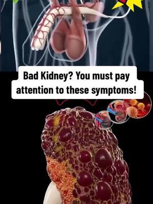 #kidneyfailure #kidneystone #kidney #health #Recipe #kidneydisease #fyp #cystitis 