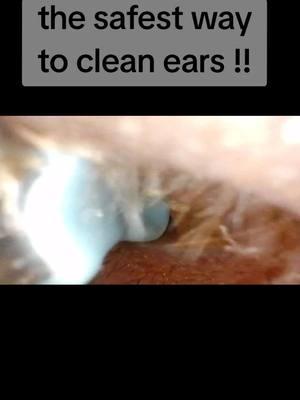 My kid has alot of ear wax and this is the safest way to clean it !!#earwaxtool #wax #earcamera #clleantok #clean #camera #earwaxcleanerwithcamera #earwax #ear 