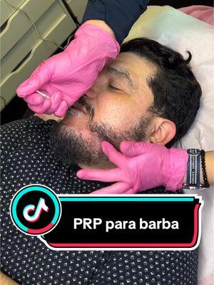 PRP para barba! Hemos visto un muy buen avance! Gracias @najarmedia y @marthasofia.romero 🎥! #prp #prpcapilar #plasmaricoenplaquetas #plasmafibroblast #najarmedia 